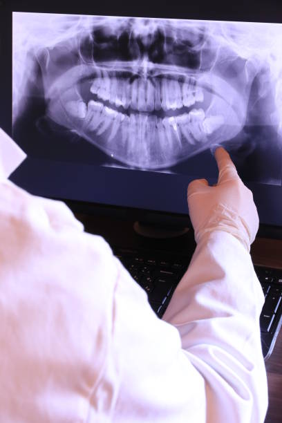 Best Emergency Dentist for Knocked-Out Tooth in Aspen, CO